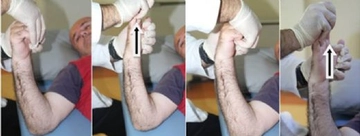 Felç Egzersizleri Yüz Felcinde Uygulanacak Egzersizler